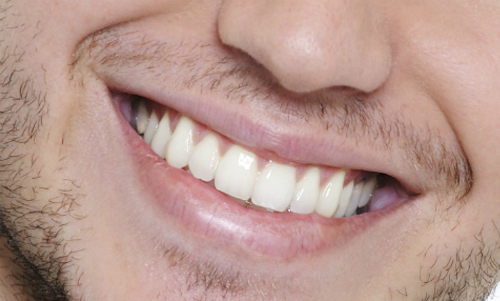 Nam giới thường ít quan tâm đến sức khỏe răng miệng hơn nữ giới.